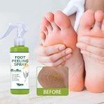 Foot Peeling Spray 100 ml