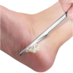 Calluse removal spatula